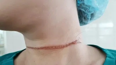 Cảnh báo tai nạn từ thả diều