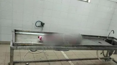 Bé trai 18 tháng tuổi nghi bị bạo hành tử vong ngay ngày quốc tế thiếu nhi