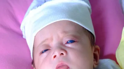 'Thiên thần mắt xanh' kỳ lạ chào đời ở Đồng Nai