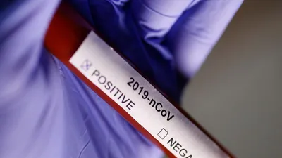 Người nghi ngờ nhiễm virus Corona, nên khám ở đâu? 