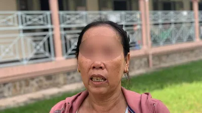 Bé 3 tuổi bị mẹ đánh chấn thương sọ não: Bà ngoại xin tha thứ