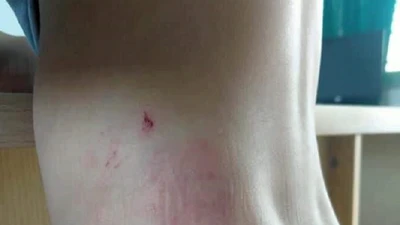 Chuyển công an huyện vụ bé 9 tuổi bị cha bạo hành