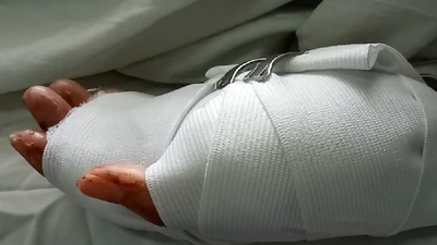 Cô gái bị nhóm thanh niên truy sát trong quán game bắn cá