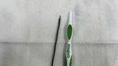 Lấy ruột viết và thân bàn chải đánh răng trong dạ dày nam thanh niên