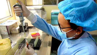 Loạn giá xét nghiệm kháng thể SARS-CoV-2