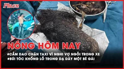 Nóng hôm nay: Cầm dao chặn taxi vì nghi vợ ngồi trong xe; Búi tóc khổng lồ trong dạ dày một bé gái