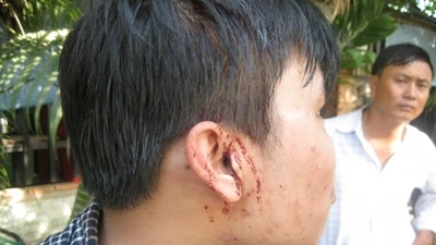 Clip công an dựng lại hiện trường vụ hai phóng viên bị hành hung