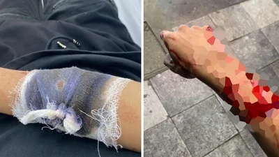 Đi xem Euro về, thiếu niên 17 tuổi bị nhóm cướp chém trọng thương và lấy đi xe máy