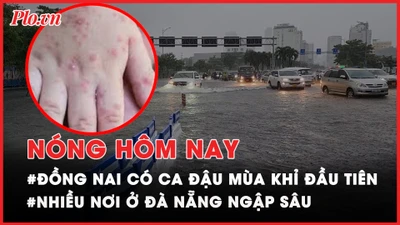 Nóng hôm nay: Phát hiện ca bệnh đậu mùa khỉ đầu tiên tại Đồng Nai