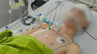 Nam sinh lớp 8 bị đánh chấn thương sọ não tử vong