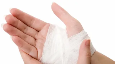 Mẹo hay dễ làm: Mẹo cầm máu vết thương