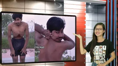 Vui độc lạ: ‘Dị nhân’ xoay ngược đầu, di chuyển dạ dày