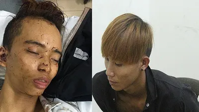 Camera ghi lại cảnh 2 tên cướp đâm người ở Thủ Đức