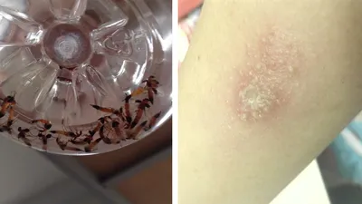 Kiến 3 khoang cực độc tấn công trong mùa thi