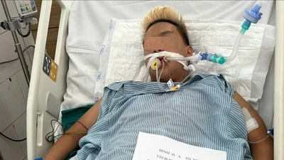 Nam thanh niên 17 tuổi tổn thương phổi nặng vì hút thuốc lá điện tử chứa ma túy