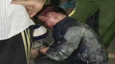 Trộm xe bị phát hiện, rút dao đâm 2 người trọng thương