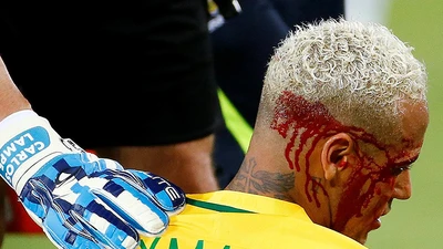 Neymar đổ máu ở Nam Mỹ, trời Âu đau lòng