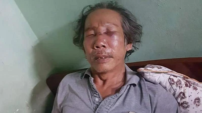 Triệu tập bảo vệ chung cư đánh người già nhập viện