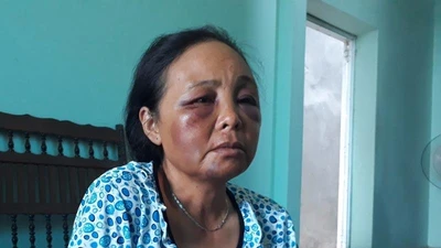 2 phụ nữ bị đánh vì nghi bắt cóc: Họ quá hung hãn!