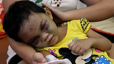 Vụ bé 4 tuổi bị hành hạ: Ai được quyền nuôi bé Ngân?