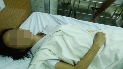 Bắt kẻ tạt acid làm hai nữ sinh viên bị thương