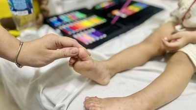 Chăm sóc trẻ mắc tay chân miệng tại nhà 