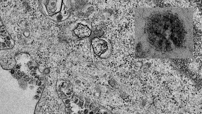 Đại học Hong Kong công bố những hình ảnh đầu tiên về quá trình phân bào của virus 2019-nCoV. Ảnh: BLOOMBERG