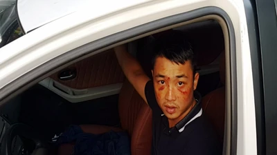 Truy bắt 2 kẻ nổ súng, chém người gần chợ Quán Lau