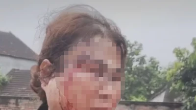  Con ủng hộ mẹ ‘đi bước nữa’ nhưng mẹ bị chồng trẻ bạo hành dã man 