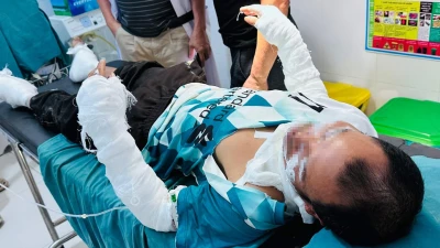 Dùng bình gas thui thịt chó, 2 người đàn ông bị bỏng 38% cơ thể 