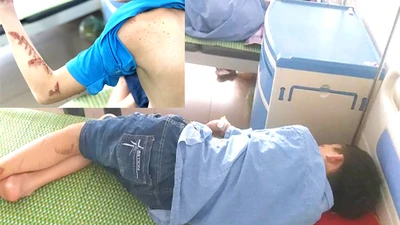 Cháu D. đang được chăm sóc tại Trung tâm Y tế huyện Yên Phong. Ảnh: TP