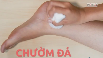 Mẹo xử lý nhanh khi bị gãy xương, bong gân, trật khớp