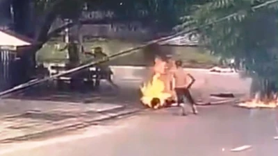 Cô gái bị tưới xăng đốt vì đánh ghen bị bỏng 30%