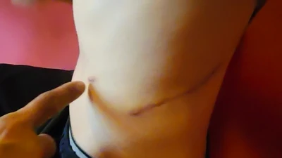 Hành vi mua bán thận sẽ bị xử lý thế nào?