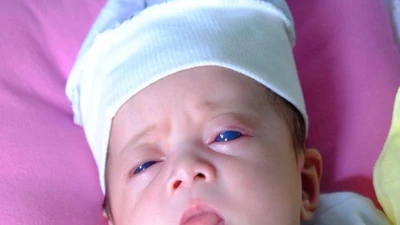 'Thiên thần mắt xanh' kỳ lạ chào đời ở Đồng Nai