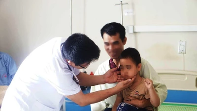 Sau trận ho, sốt, bé 5 tuổi mọc lông đầy người