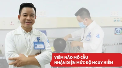 Nhận diện viêm não mô cầu: Đừng để nhầm lẫn với cảm cúm thông thường