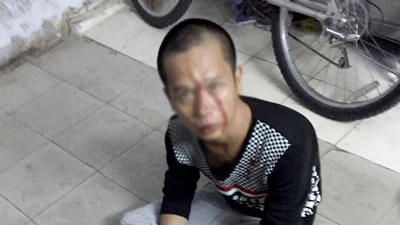 Tên cướp giật bị kẹt xe ngay trước mặt CSGT