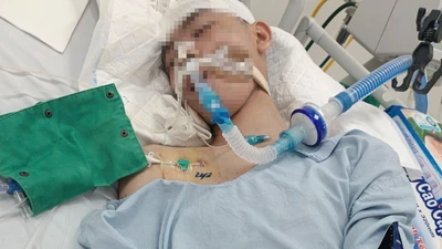 Vụ nam sinh lớp 8 bị đánh chết não: Công an cảnh báo việc đăng tải sai bản chất sự việc