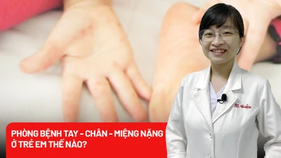 Phòng bệnh tay chân miệng nặng ở trẻ em thế nào? 