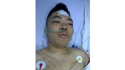 Clip Người bị Việt kiều đâm thấu tim có võ nhưng không đánh lại