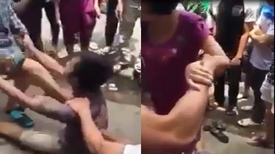 Clip Cấp cứu hay tra tấn nạn nhân? 