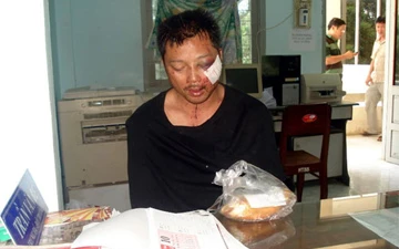 Chưa tìm thấy số vàng bị cướp ở Bình Thuận