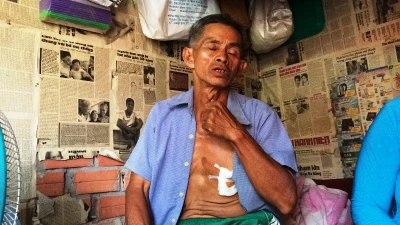 Gia cảnh khó khăn của người xe ôm bị cướp đâm trọng thương