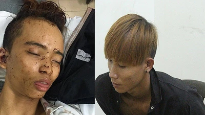 Camera ghi lại cảnh 2 tên cướp đâm người ở Thủ Đức