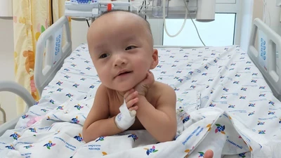 25 ngày sau ca mổ tách dính, cặp song Nhi đã tự ngồi dậy