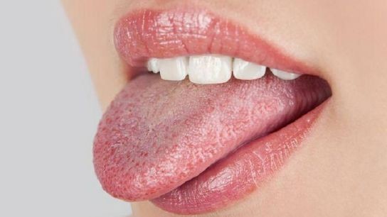 Có những phương pháp điều trị nào được sử dụng để giảm mụn lưỡi?
