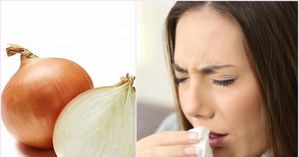 Chữa dứt điểm cảm, ho, sổ mũi chỉ với một củ hành tây