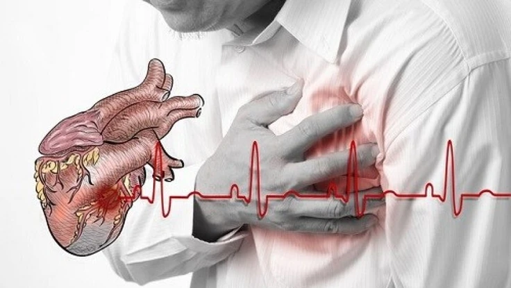 Các dấu hiệu cảnh báo ngừng tim đột ngột