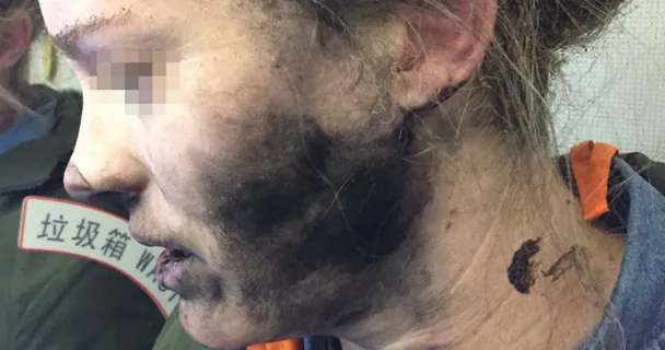 Cháy nổ thiết bị công nghệ hiểm họa cần được cảnh báo 